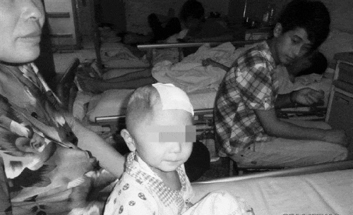 4岁男童被继母打瘪半边脑袋 生父继母卷钱消失