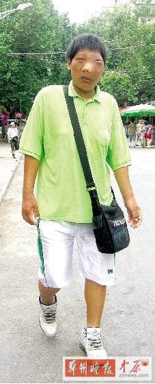 男子“长得吓人”想挣钱供弟妹 百家企业伸援手